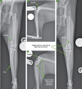 FIGURE 1. Radiographs of a 7-year-old male neutered domestic shorthaired cat that presented with chronic left hindlimb lameness. Medial patellar luxation (MPL) was diagnosed and treated conservatively until lameness worsened to grade 4/5. At the time of radiography, the patient was diagnosed with grade III MPL in the left hindlimb and grade II MPL in the right hindlimb. (A) Preoperative ventrodorsal view showing bowing of the tibia. Radiologist reported remodeling of the margin of the medial femoral trochlea on the left hindlimb. Note the medial location of the patella. (B) Preoperative mediolateral view. (C) Postoperative ventrodorsal view after a mini tightrope procedure, medial retinaculum release, and lateral fascia imbrication. CCL rupture was diagnosed during surgery. (D) Postoperative mediolateral view. Courtesy of VCA Animal Specialty Center of South Carolina, Columbia, South Carolina